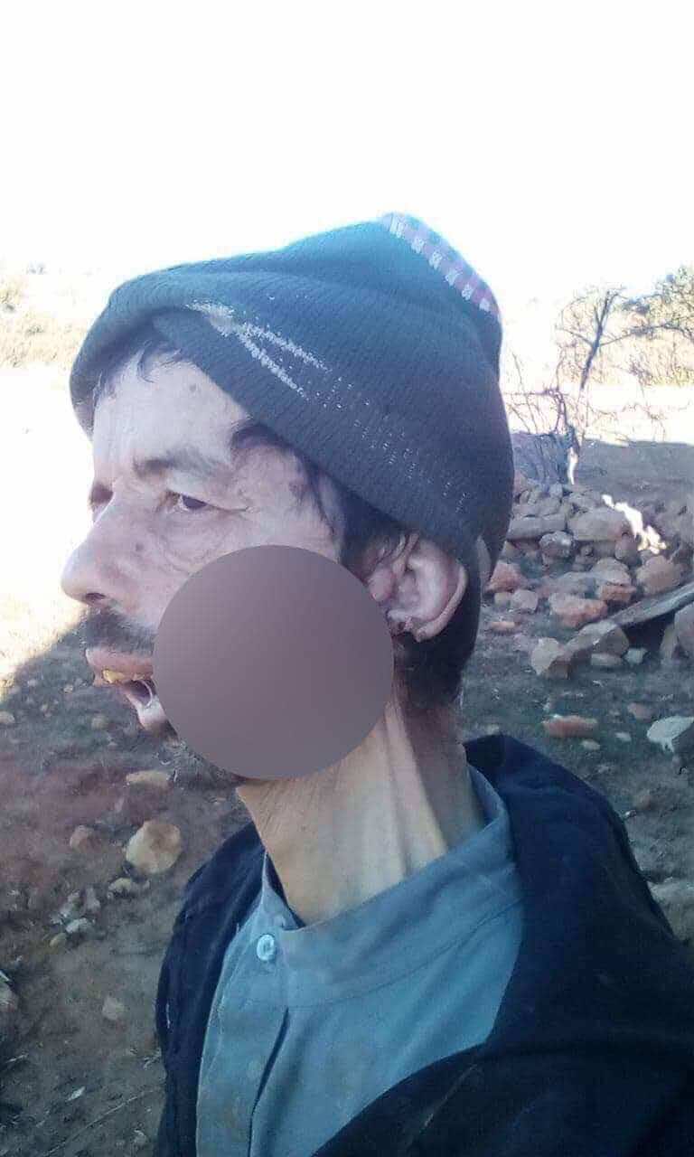 يصارع السرطان وحيدا بين جبال إقليم الصويرة بعدما تخلى عنه أبناؤه.. محمد حالة إنسانية تدمي القلب! - صورة