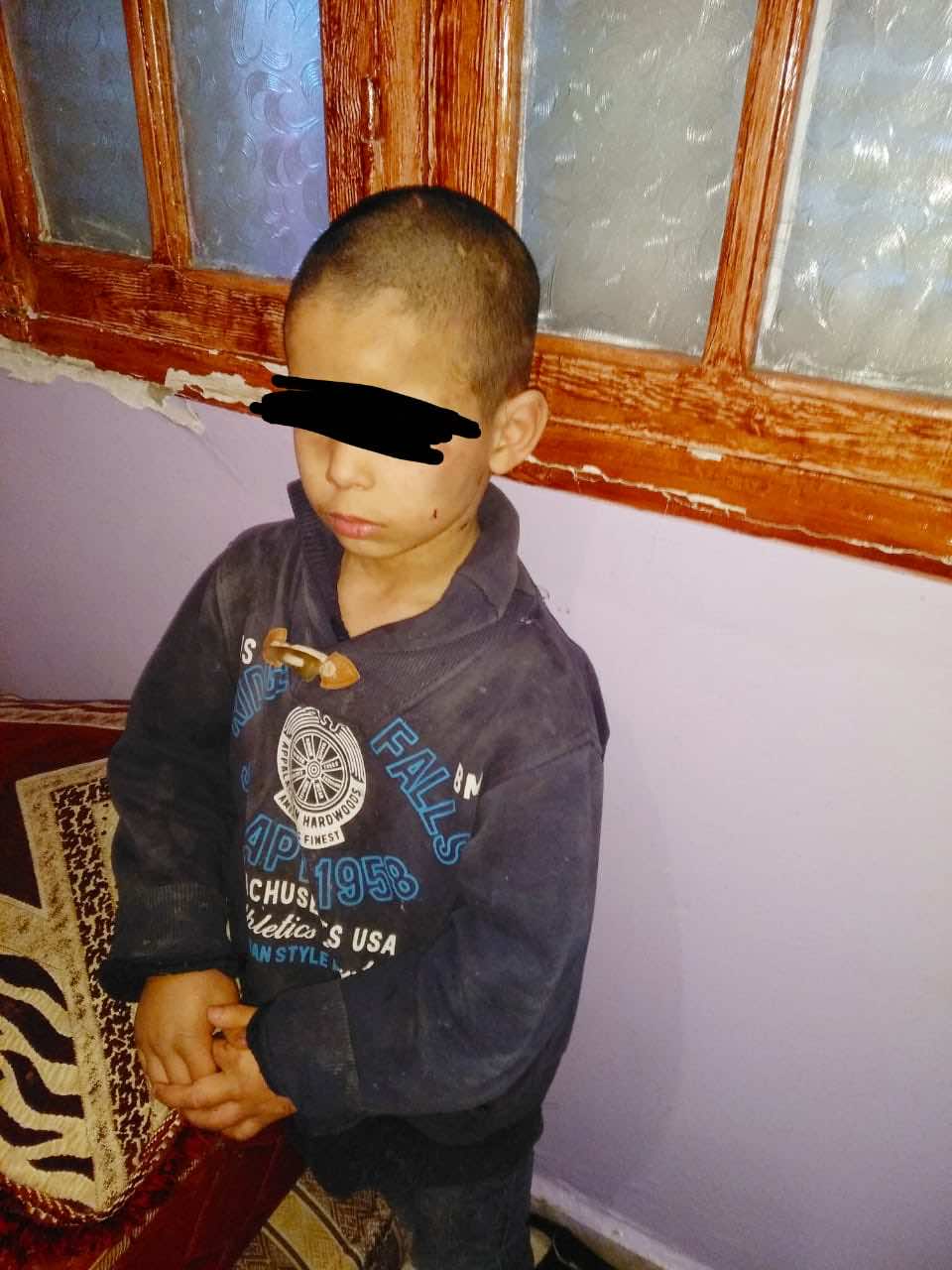 عاقبته بالعض والكي بالسجائر.. تفاصيل تعذيب طفل قاصر في سطات