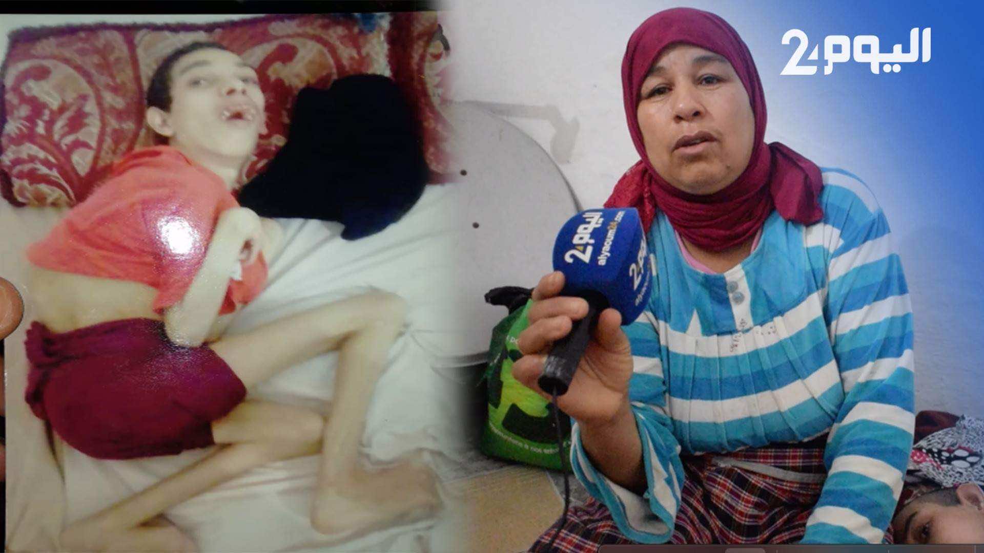 شاب ولد بمرض نادر ألزمه الفراش 31 سنة..ووالدته: أناشدكم لمساعدته.."ماسخيتش بيه"-فيديو