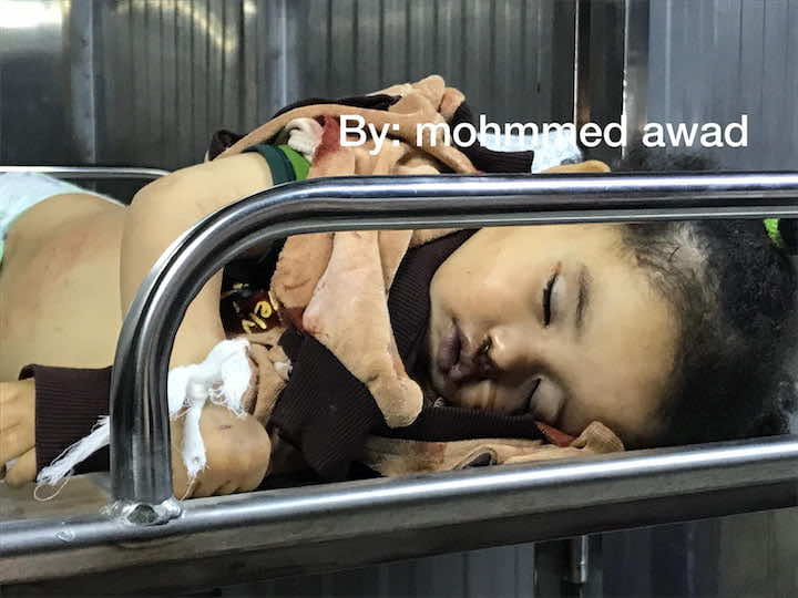 جراء الغارات الإسرائيلية على غزة.. وزارة الصحة تعلن استشهاد طفلة فلسطينية في ربيعها الثاني