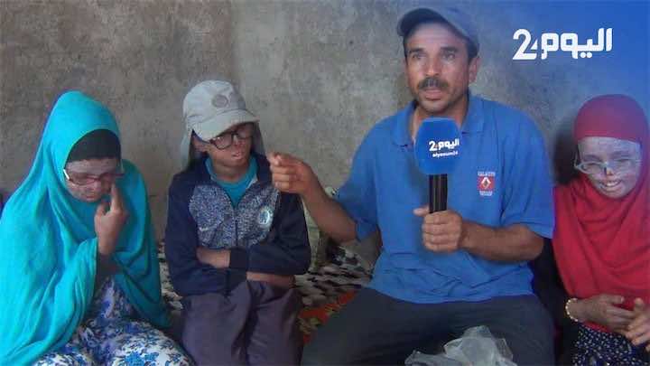 مأساة 3 إخوة تهددهم الشمس بالموت.. والعائلة تعاني وتطلب المساعدة من المغاربة- فيديو