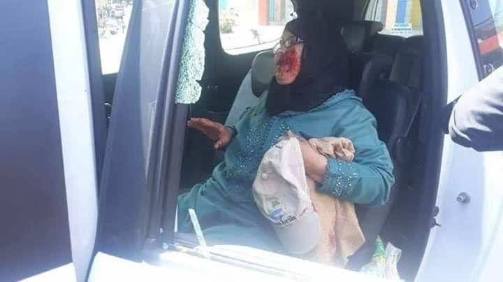 مجهول يهاجم طاكسي كبير بالحجارة ويتسبب في "سقوط" أسنان سيدة-صور