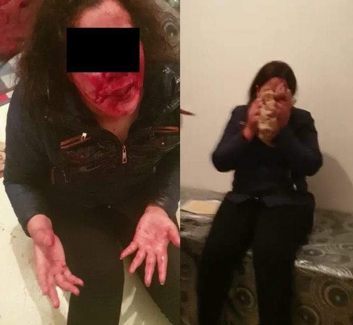 زوجة بالبيضاء تعرض عشيقة زوجها للتعنيف.. والأمن يدخل على الخط بعد نشر الفيديو