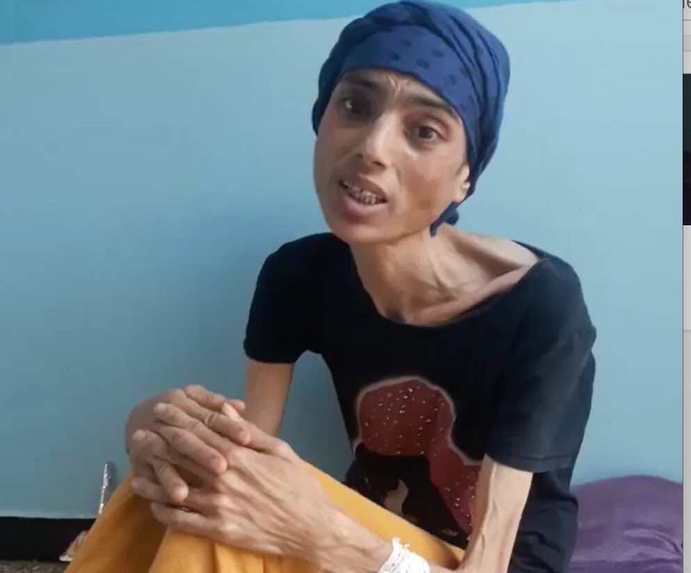 قصة إنسانية تدمي القلب..أم من خريبكة فرقها المرض عن أطفالها الأربعة تنشد المساعدة-فيديو