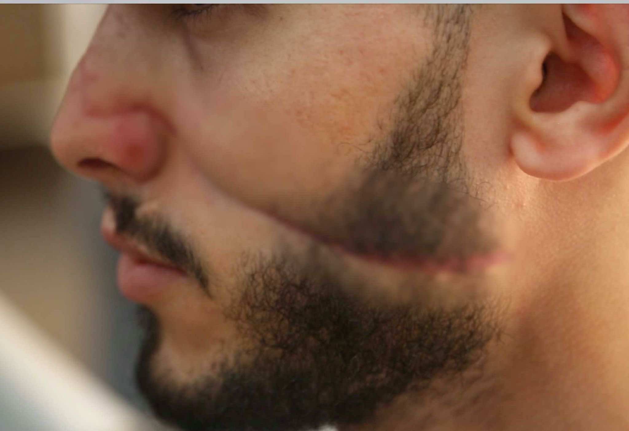 "المغاربة يرفعون شعار "لا للتشرميل".. وضحاياه: لم نعد نشعر بالأمن ونعاني عقدا نفسية
