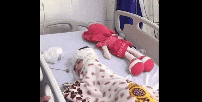 جنة.. قصة وفاة طفلة تعرضت للتعذيب والكي في مناطقها الحساسة