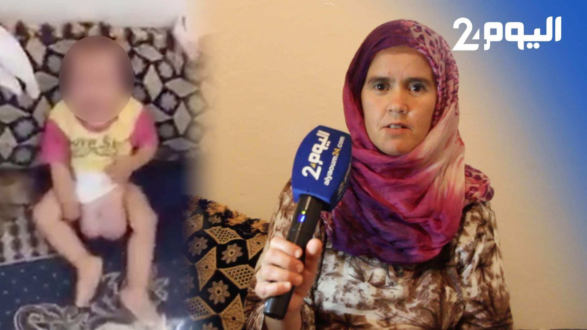 مؤلم- طفل يعاني التهابا في خصيتيه.. أصبح حجمهما "ضخما" ووالدته تناشد وزير الصحة - فيديو