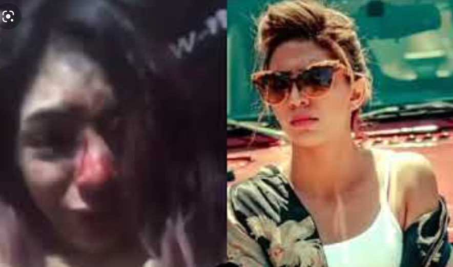 مغنية الراب "بسيكو كوين" تتعرض لاعتداء شنيع.. تضرر وجهها - فيديو