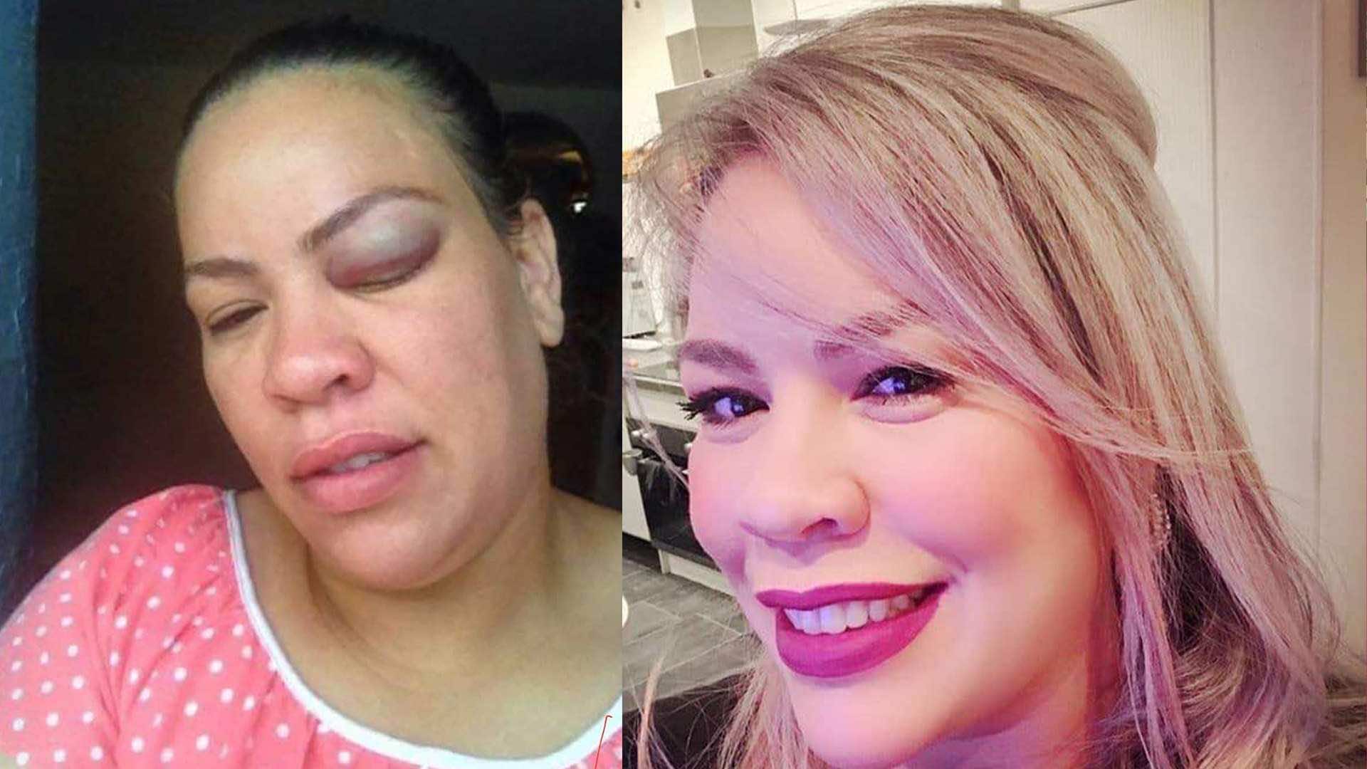 حنان تكشف قصة تعنيفها في "ماستر شاف": سامحت المعتدي وشاركت قصتي لتستفيد منها أخريات - حوار