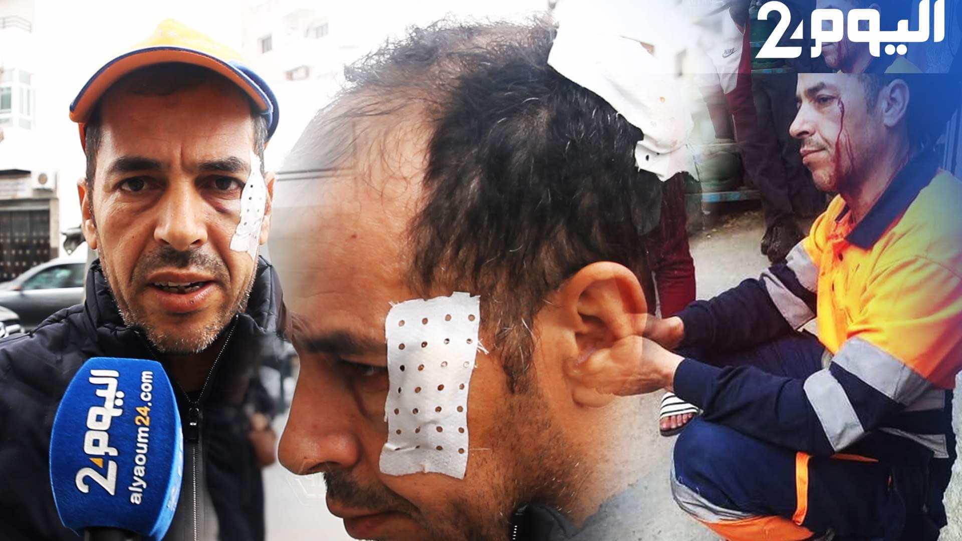 عامل نظافة يحكي تفاصيل الاعتداء عليه: تعرضت للضرب من طرف شخصين خلال قيامي بعملي وأشعر بـ "الحكرة"-فيديو