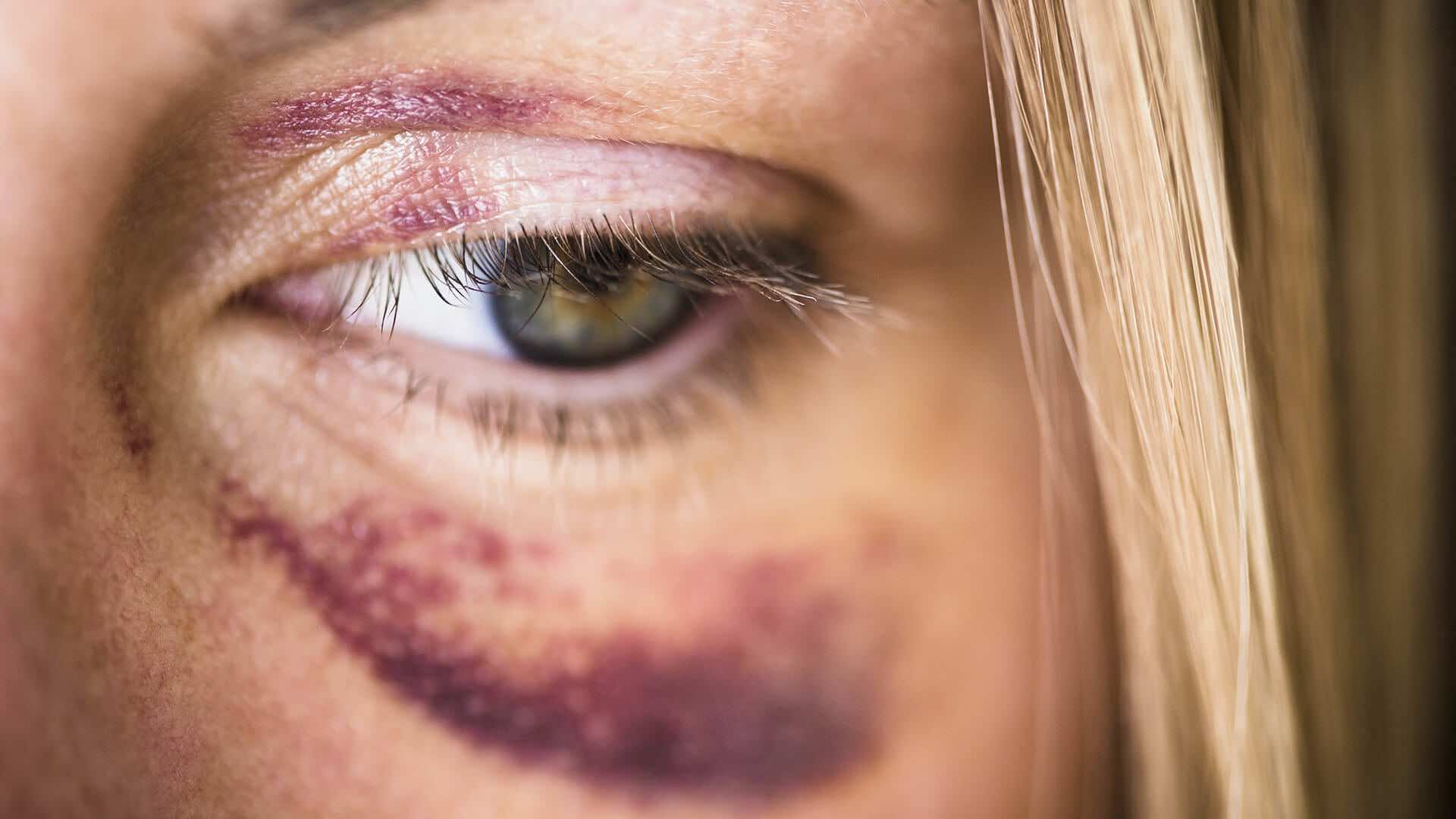 العنف ضد النساء داخل إطار الزوجية مرتفع جدا مقارنة بباقي الفئات الأخرى (اتحاد العمل النسائي)