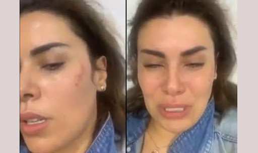 واقعة الاعتداء على الفنانة أماني السويسي.. القبض على متعهد الحفلات بعدما اتهمته بتعنيفها