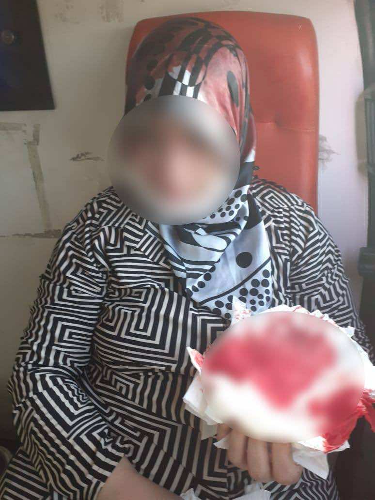 شاب عشريني يروع سكان حي مراكشي.. والمواطنون يطالبون السلطات بالتحرك لحمايتهم