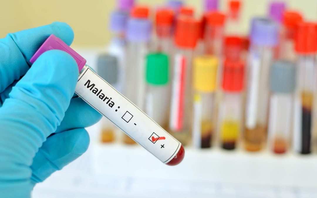 بعد تراجع الإصابات الجديدة بكورونا.. الجزائر تواجه الملاريا وتسجل مئات الحالات في شهر واحد