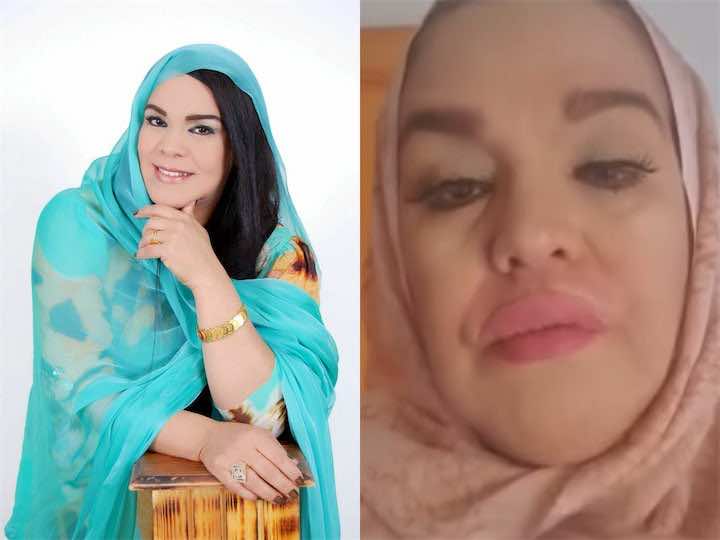 رشيدة طلال ضحية لعملية تجميل فاشلة..أثرت على شكلها وعلى النطق
