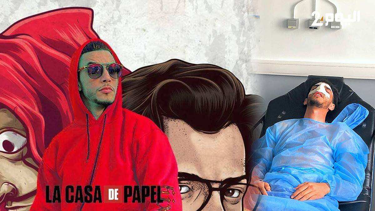 إصابة على مستوى الأنف تؤجل التحاق اللاعب المغربي محسن نشيط بـ" لا كاسا دي بابيل"