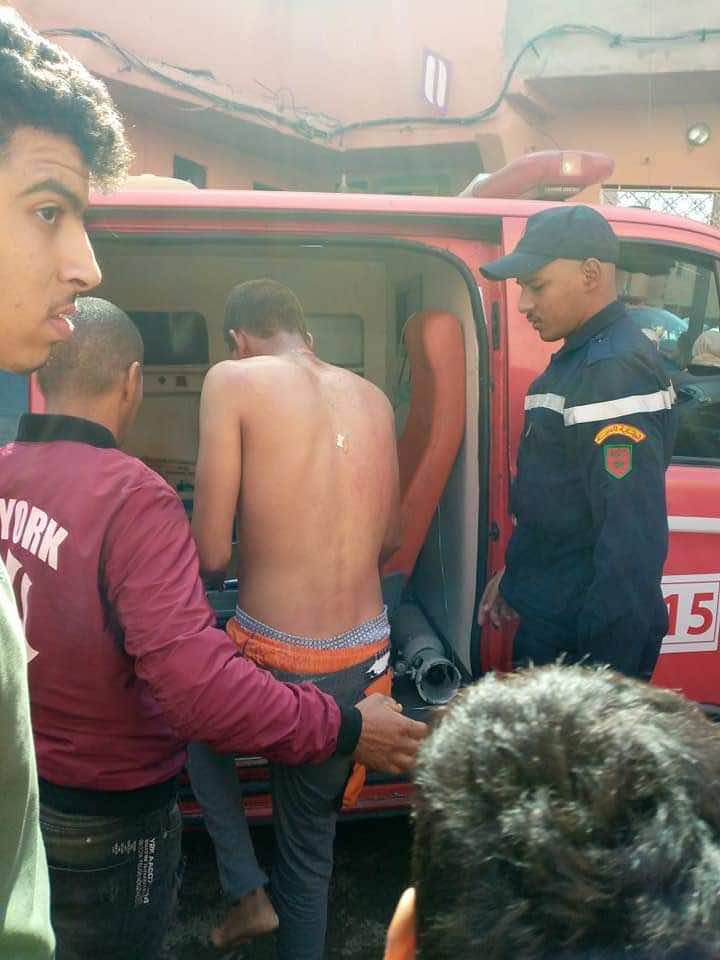 طالب يلفظ أنفاسه بعد إصابته بحروق في مراكش