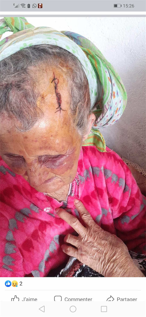 اغتصاب عجوز عمرها 80 سنة والاعتداء عليها بالسلاح الأبيض
