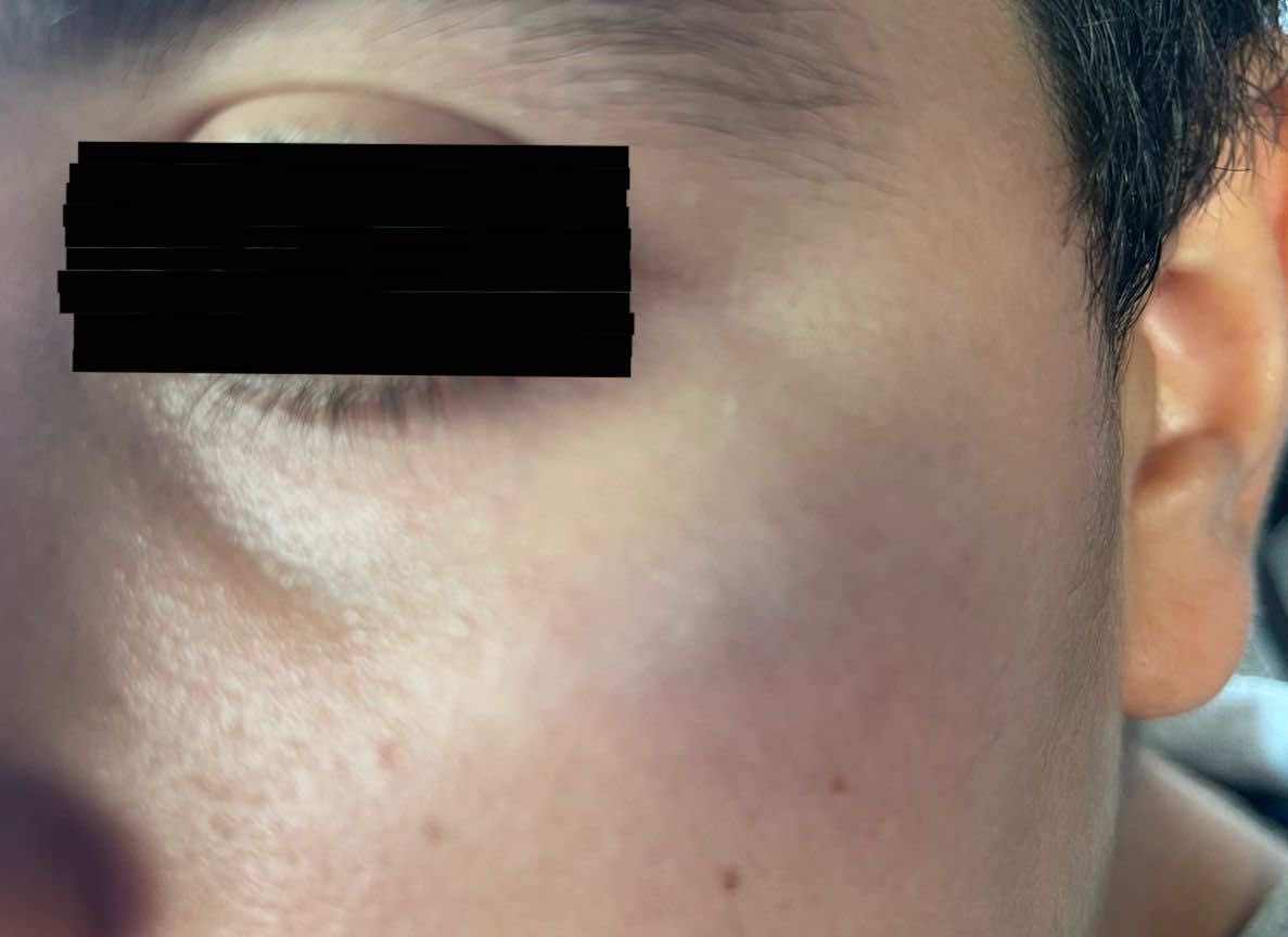 تلميذ بمؤسسة تعليمية خاصة بالعرائش يتهم مديره بتعنيفه وولي أمره يطالب بإنصافه