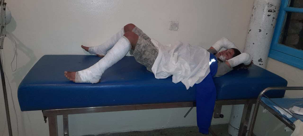 مأساة... نجاة 3 تلاميذ من موت محقق بسبب "بوطا غاز" بتاونات