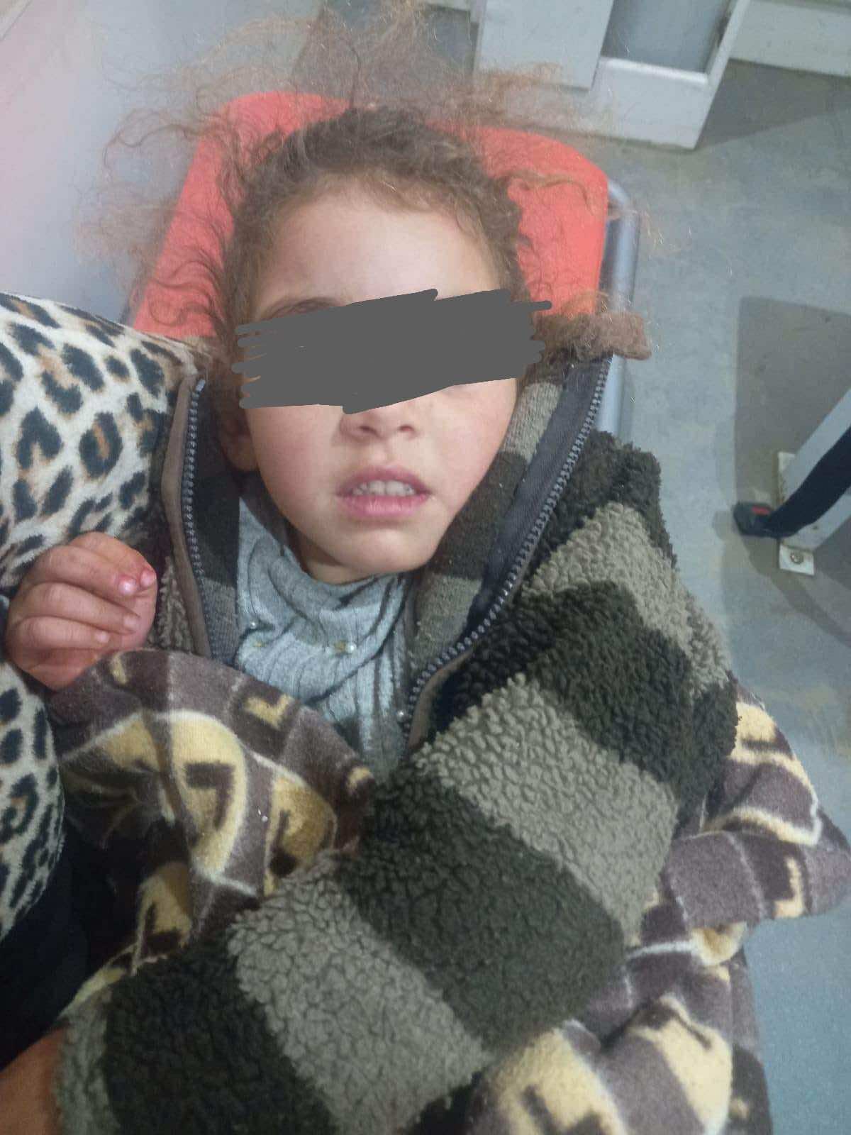 طفلة أصيبت بحروق تخلق الجدل بتاونات وجهات تدخل على الخط