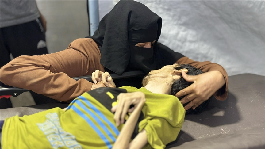 وفاة شاب بسوء التغذية في غزة جراء التجويع الإسرائيلي