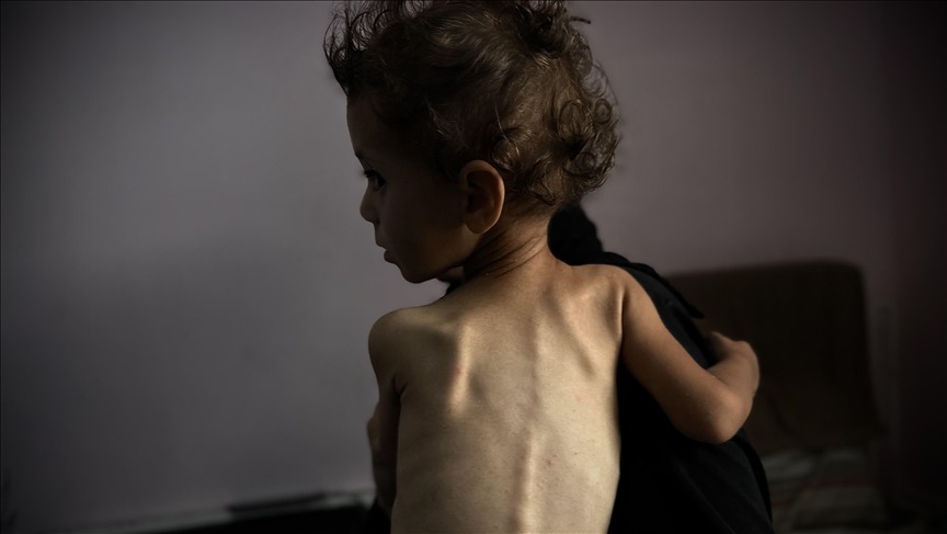 إسرائيل تطالب بسحب تقرير الخبراء عن المجاعة في غزة "فورا"