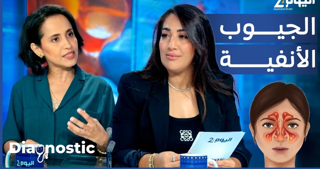 الجيوب الأنفية... متى يصبح الألم إنذارا يستدعي الانتباه؟